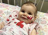 Abigail was bathing baby Ayla when she felt a small lump on the top of her head. What came next would change their lives forever