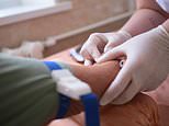 New test that could identify signs of Alzheimer’s disease set for Australia